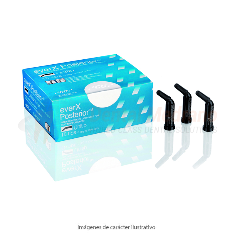 Ever X Posterior Composite Fibrado- Universa