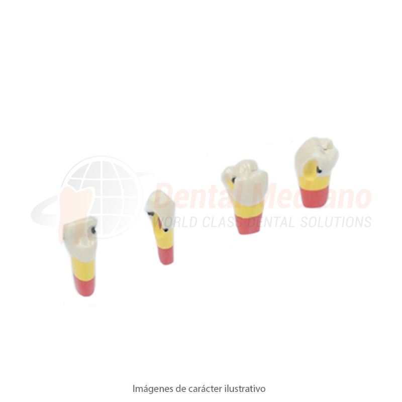 Diente Frasaco C/caries AG-3ZKN 21 -26